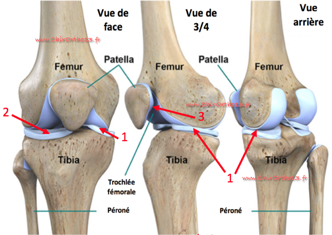 Lexique Genou D g n ratif usure Arthrose Du Genou ChirOrtho13 fr Lexique Genou D g n ratif usure Arthrose Du Genou ChirOrtho13 fr