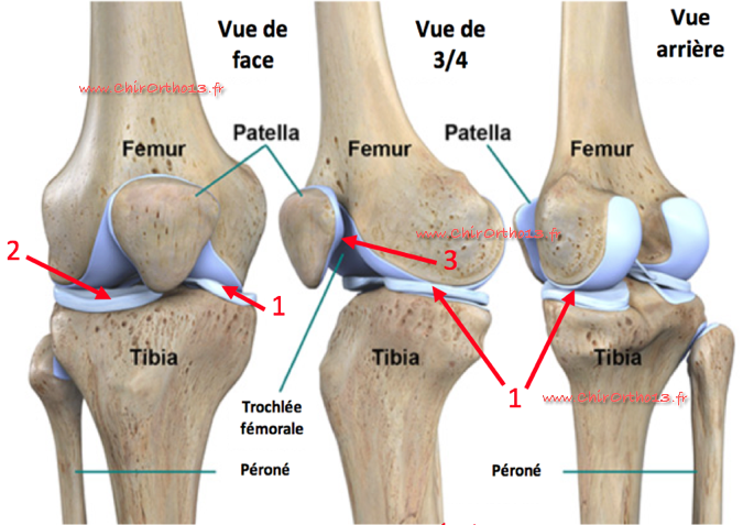 Prothèse totale ou prothèse partielle de genou : comment décider ?