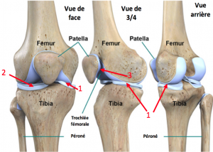 Anatomie du genou : comprendre les causes de douleurs du genou et de l'arthrose