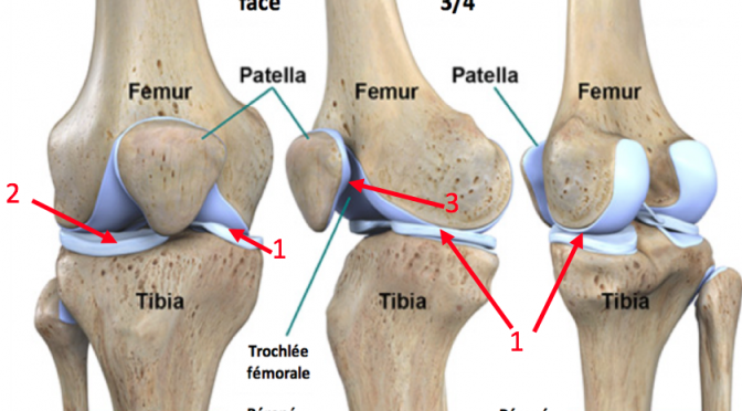 Anatomie du genou : comprendre les causes de douleurs du genou et de l'arthrose