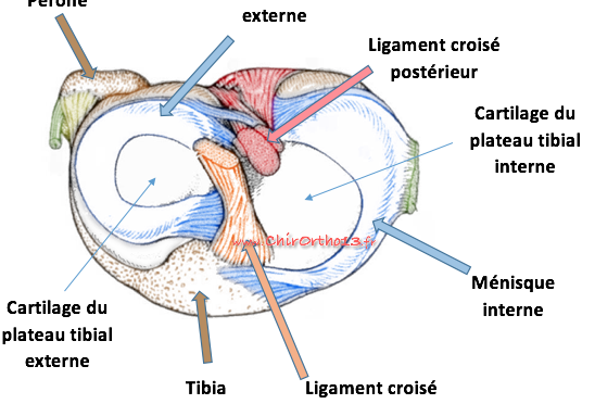 Arthroscopie du genou et chirurgie des ménisques